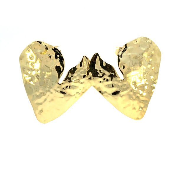Arete corazon asimetrico